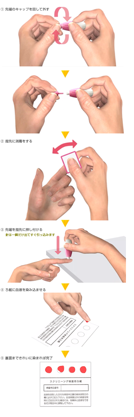検体の採取方法